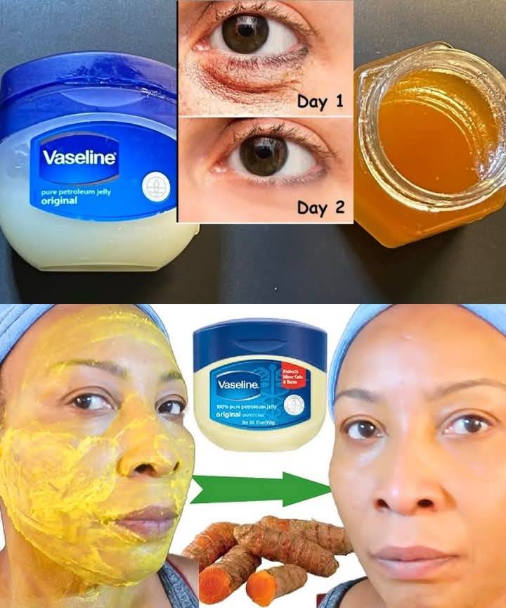 Vaseline mix Turmeric: Benefits For Skin, Lips & Hair