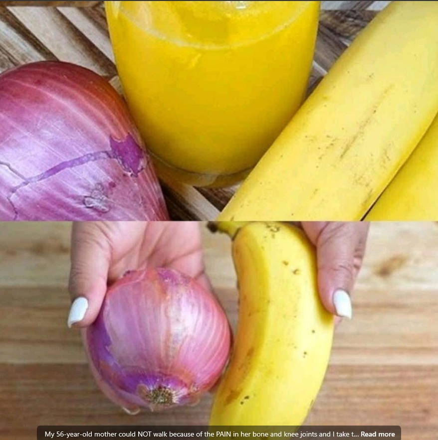 “Banana & Onion: The Unlikely Duo That Naturally Soothes Joint Pain”