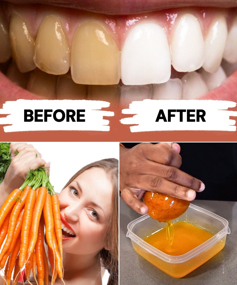 The Quickest Way to Make Carrot Oil in 5 Minutes for Teeth Whitening and 12 Other Health Benefits
