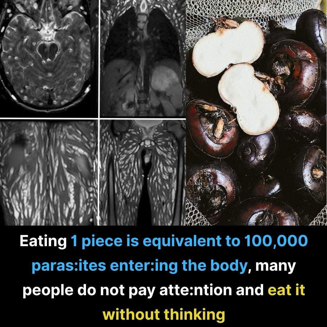 Just One Bite Can Be Harmful: The Hidden Dangers of Foodborne Parasites