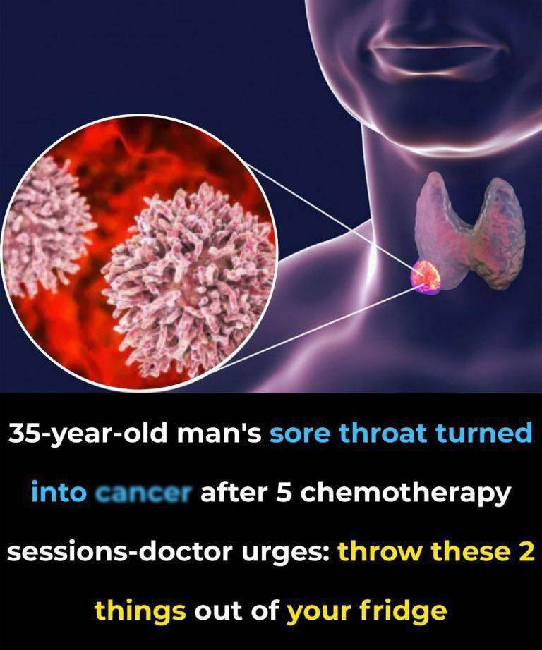 35-Year-Old Man’s Sore Throat Turned into Can.cer After 5 Chemotherapy Sessions—Doctor Urges: Throw These 2 Things Out of Your Fridge